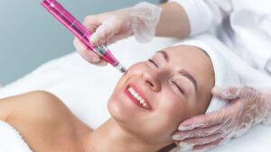 Mesoterapia facial con vitaminas revitaliza tu piel | LB Medical Spa