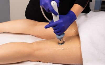 Tratamientos combinados para eliminar la celulitis y flacidez