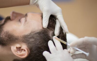 Estimula el crecimiento de tu cabello con PRP Capilar