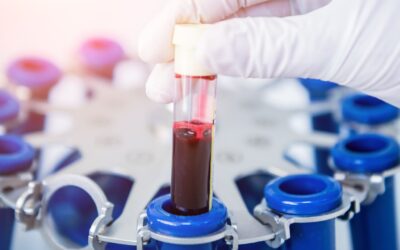 Plasma Rico en Plaquetas | Conoce sus beneficios